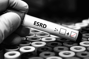 Positive ESRD test